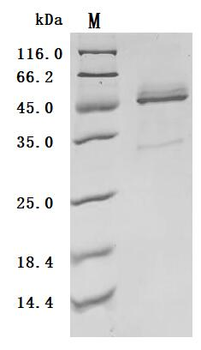 Recombinant Human Interleukin-21 (IL21) (Active)