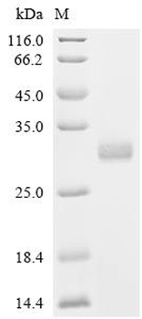 Recombinant Human Calcineurin B homologous protein 1 (CHP1)