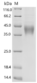 Recombinant Mouse Natural cytotoxicity triggering receptor 1 (Ncr1), partial