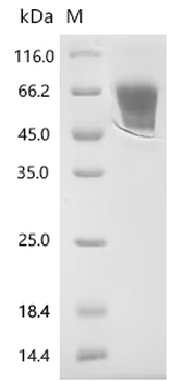 Recombinant Mouse Muscle, skeletal receptor tyrosine-protein kinase (Musk), partial