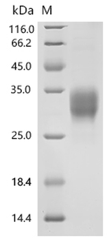 Recombinant Mouse T-cell surface glycoprotein CD8 alpha chain (Cd8a), partial