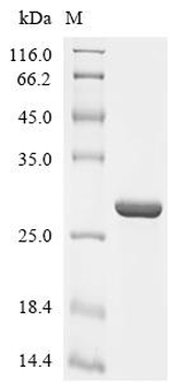 Recombinant Influenza A virus Polymerase basic protein 2 (PB2), partial