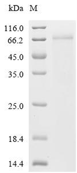 Recombinant Human Zinc finger Y-chromosomal protein (ZFY), partial