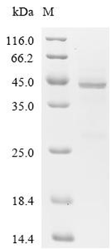 Recombinant Human Eukaryotic translation initiation factor 1A, Y-chromosomal (EIF1AY)