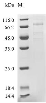Recombinant Human Endothelial lipase (LIPG)