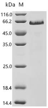 Recombinant Human Neurogenic locus notch homolog protein 1 (NOTCH1), partial