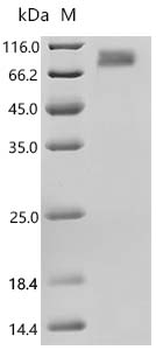 Recombinant Human Hepatitis A virus cellular receptor 1 (HAVCR1), partial