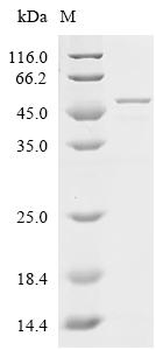Recombinant Human Endoplasmic reticulum resident protein 29 (ERP29)
