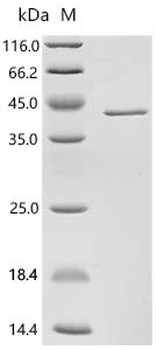 Recombinant Human Endoplasmic reticulum resident protein 29 (ERP29)