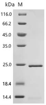 Recombinant Human Histone H2A.J (H2AJ)
