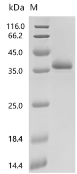 Recombinant Mouse Filamin-A (Flna), partial