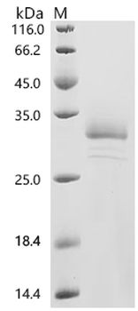 Recombinant Mouse Desmoplakin (Dsp), partial