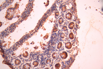ACADVL Antibody