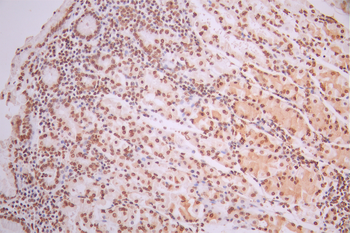 PRKCD Antibody