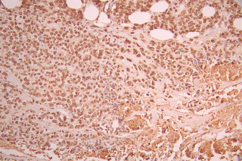PRKCD Antibody