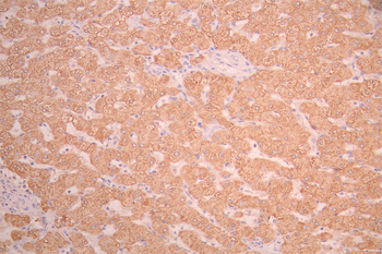 CES1 Antibody