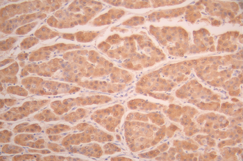 CES1 Antibody