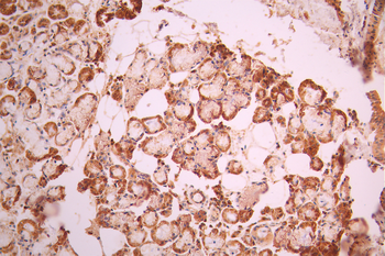 SYNGAP1 Antibody
