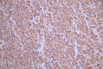 FCER2 Antibody