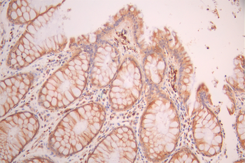 Fadd Antibody