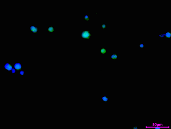 MALT1 Antibody