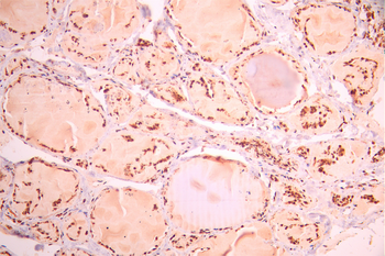 USP28 Antibody