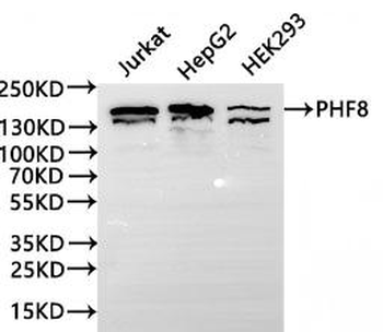 PHF8 Antibody