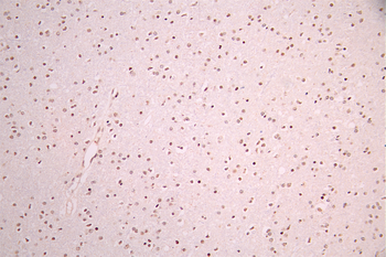 PHF8 Antibody