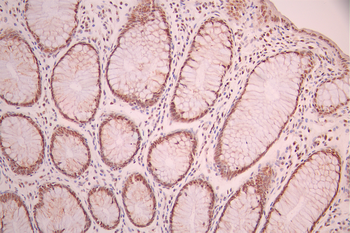 PHF8 Antibody