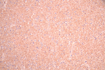 HPRT1 Antibody