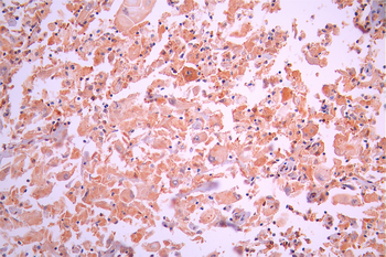 HPRT1 Antibody