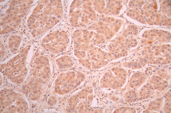 RAB22A Antibody