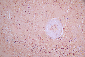 DUT Antibody