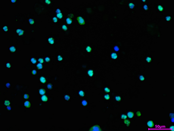DUT Antibody