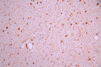 JPT1 Antibody