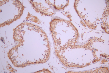 ATG4A Antibody