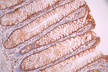 ATG4A Antibody