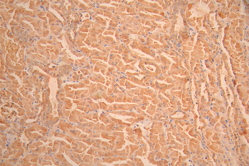 SLIT2 Antibody