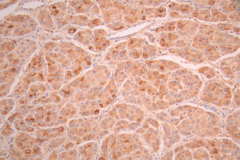 SLIT2 Antibody