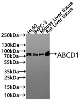 ABCD1 Antibody