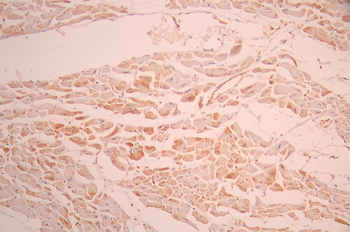 PPIF Antibody