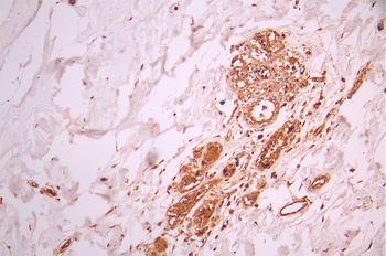 PPIF Antibody