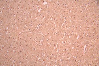 ZIC1 Antibody
