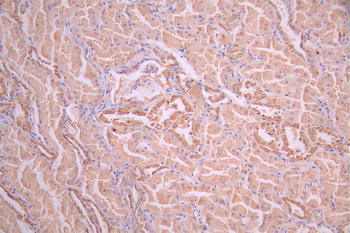 IDH2 Antibody
