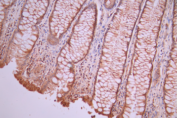 IDH2 Antibody