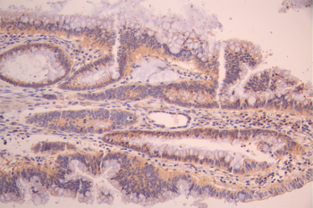 RASEF Antibody