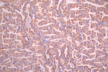 NDUFS2 Antibody
