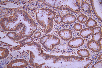 NDUFS2 Antibody