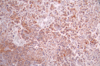 BST2 Antibody