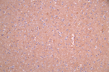 HOMER1 Antibody